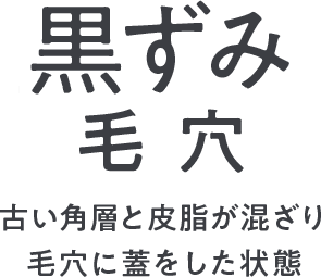 古い角層と皮脂が混ざり毛穴に蓋をした状態