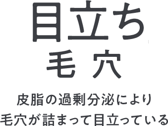 皮脂の過剰分泌により毛穴が詰まって目立っている